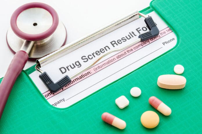 Drugs and drug screen result form in file with stethoscope on white background.